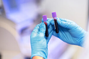 header-biometria-hematica-laboratorio-analisis-clinicos