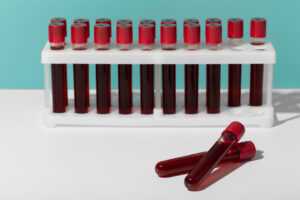 header-quimica-sanguinea-laboratorio-analisis-clinicos