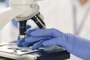 Unrecognizable lab worker inspecting blood sample under microsco