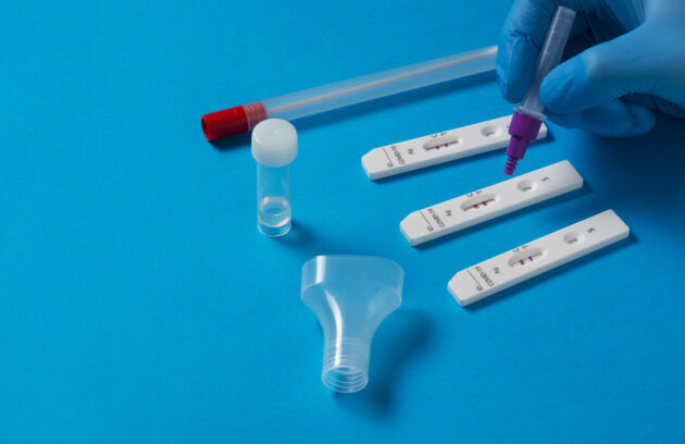 Diferencia entre Pruebas PCR y Pruebas de Antígeno